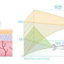 Botem(보탬) 이미지