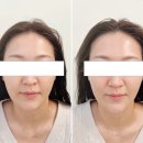 코리아엔제이 | 대구 피부관리 제이라인코리아 리프팅 관리 후기