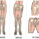 골반교정 필라테스 이미지