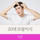 모다올의원 | 20대 모발이식 잘하는 곳, 모다올의원(6개월 후기)