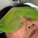 브로우원 | 분당 미금역 눈썹 잔흔제거 깔끔하게 잘하는 곳 브로우원 붉은 잔흔 제거 후기