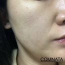 어나더뷰티 - 송파구 중대로9길 42 | 어나더뷰티