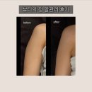 의정엔 | 경기광주 | 경안동 에스테틱 뷰티의정 팔관리 후기