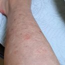 아띠의원 이미지