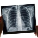 속초튼튼마취통증의학과의원 이미지