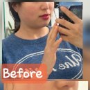 메디브로 | [고객후기] "투턱이 사라졌어요!" 순환 관리로 완성하는 수분광 탄력 라인