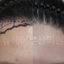 뉴헤어라인 - 순천시 | 뉴헤어라인