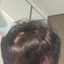 라파약국 | 두피관리 탈모샴푸 라파로페 스테이팩, 안 써본 샴푸 없던 내가 정착한 이유