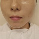 L컴퍼니엘 | 홈케어 뷰티디바이스 소노엘(SONO L) 한달 대여 후기