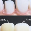 휴먼치과의원 이미지