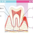 술을 자주 마시는 사람은 왜 충치가 되기 쉬운가？ 이미지