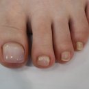 아이캔네일 이미지