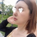 파리바게뜨 광교중흥점 | 광교 울쎄라 400샷 내돈내산 후기 (일주일 후 효과 , 붓기, 통증, 가격)