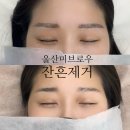 더블유오 | [공지] 울산 달동 잔흔제거 미브로우 찐 고객후기