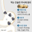 인슐린 알약… 당뇨환자, 주사바늘 고통 사라진다 이미지