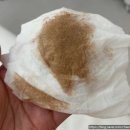 채채네일룸 | 익산 피부관리 정든에스테틱 피부 모공 관리 / 피부톤 개선 골드디톡스테라피 후기