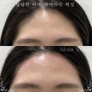 수원-1847 | 수원왁싱 만족스러운 케어 모나라운지 왁싱&amp;속눈썹 수원인계점 후기