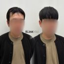 블랭크컨설팅 | 스티커증모술탈출 탈모커버에 딱 맞는 블랭크유증모술 후기!