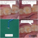 이엔치과 네이버블로그
