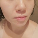 윤이나뷰티 | 선릉역 피부관리 제이제이뷰티 속건조 잡아주는 앰플 나노관리 후기