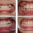 스마트하루치과의원 이미지