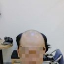 미남가발