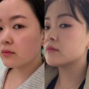 굴포천 | 인천 굴포천 인모드 후기 : 통증 효과 내돈내산 추천