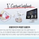 안아픈치과의원 네이버블로그