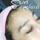 썬헤어라인 이미지