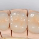 다이아몬드치과기공소 이미지