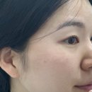 굿플레이스아산 | [아산 여드름관리] 온담테라피 여드름관리 찐 후기! 1회 만으로 수부지+홍조+여드름 구원받고 온 후기