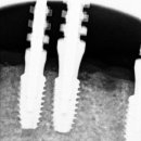 이 편한 치과기공소 이미지