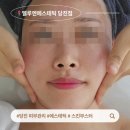 엘 스킨케어 | 당진 피부관리 엘루엔에스테틱 스킨부스터 케어 후기