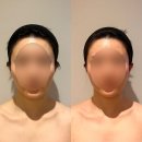 예쁜여우피부관리 | [서울/명동] 12월 연말선물로 위뷰티명동점 예쁜광대피부관리 후기