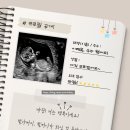 밀로아