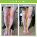 손태석 발가락운동용구 | 손태석 발가락 운동용구 파워발란스