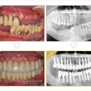 대전임플란트잘하는곳 비용까지 생각한다면 워싱턴 이미지