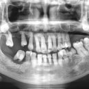 RPD치과기공소 이미지