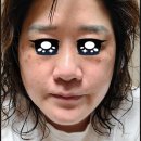 씨앤미의원 | 드디어 10번째 마지막 방문 / 포항피부과 씨앤미의원 / 내돈내체후기