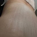 이브메디칼대구 | [대구 가꾸다] 동성로피부관리 대구등드름관리 추천