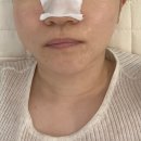 3695 | 유성구 스킨플래닝 루니샵 방문후기