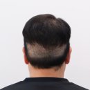 컨트롤브이
