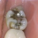 연세내일치과의원 이미지