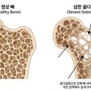 마주비어
