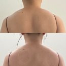 있어도 라인이 살아나는 대전피부관리! 데이미즈에서 바이오포톤 & 에너리즘 셀핏 받고 온 생생 후기