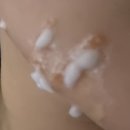 햇살이비인후과의원 | 부산 서면 천욱부피부과의원 접촉성피부염 후기