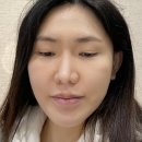 셀럽주사 첫도전! 압구정로데오역 피부과 <b>레필레오</b> 스킨부스터