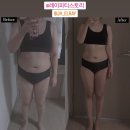 레이 피티 이미지