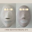 교방동134 | [마산 피부관리] 피부 피어나리 작은얼굴 디자인 관리 후기입니다~:DD