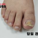 레푸스 사상점 이미지